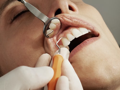 A dental clinic visit is crucial and here are three reasons why!